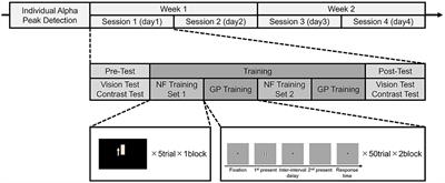 Pretraining alpha rhythm enhancement by neurofeedback facilitates short-term perceptual learning and improves visual acuity by facilitated consolidation